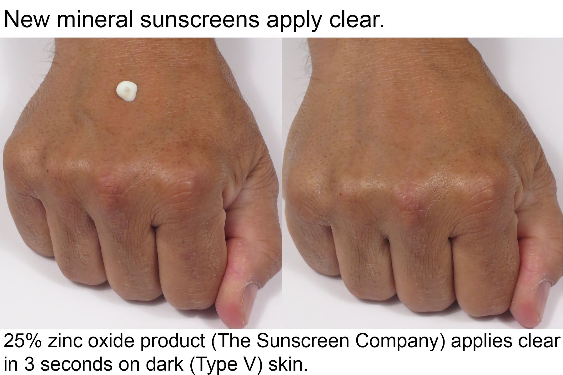 Mineral sunscreen applies clear